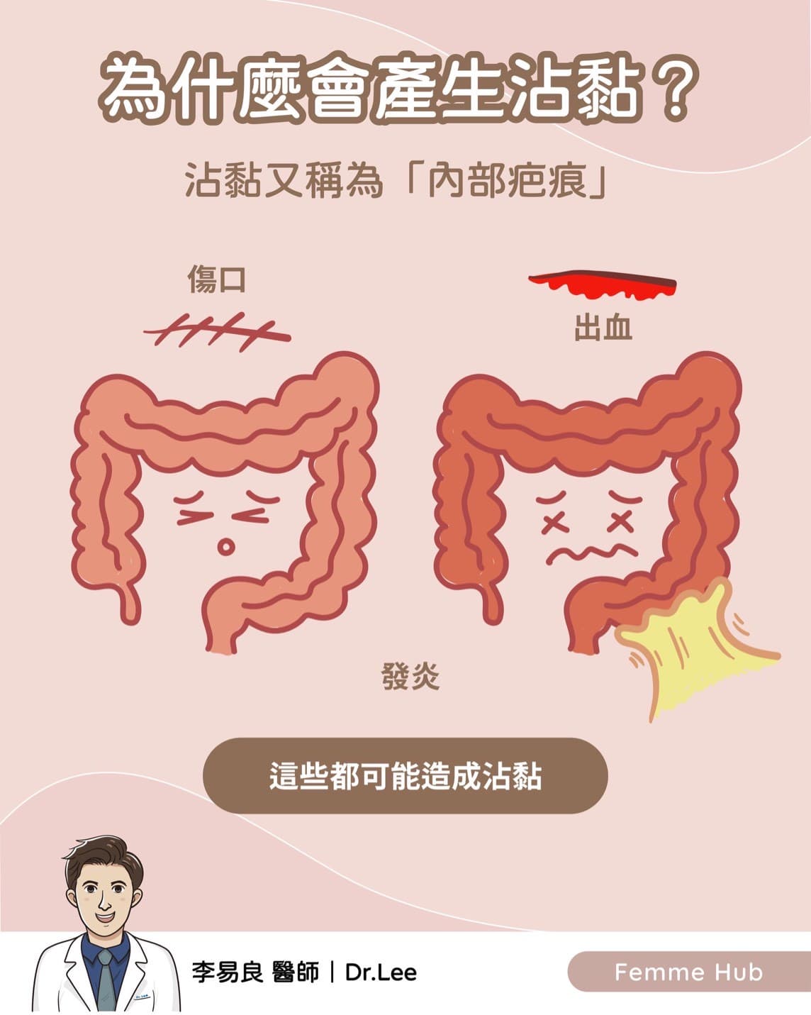 👨🏻‍⚕️為什麼會有手術後沾黏發生⁉️1.jpg