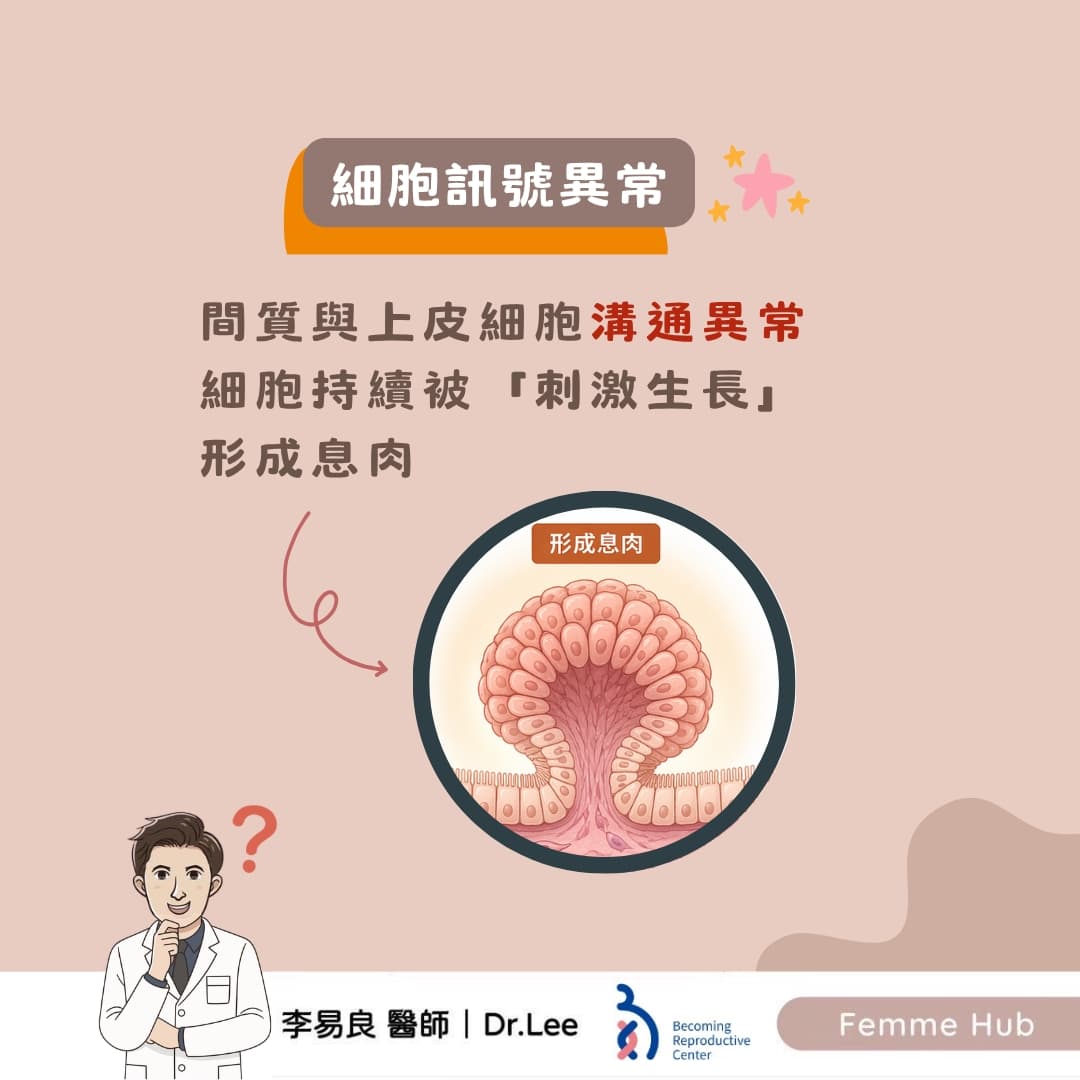 子宮內膜息肉：不只是雌激素的問題4.jpg