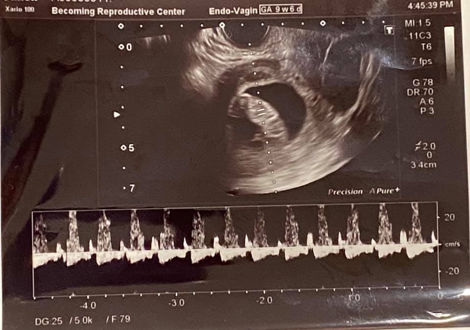 🤰懷孕了！還要擔心什麼🤔？.jpg