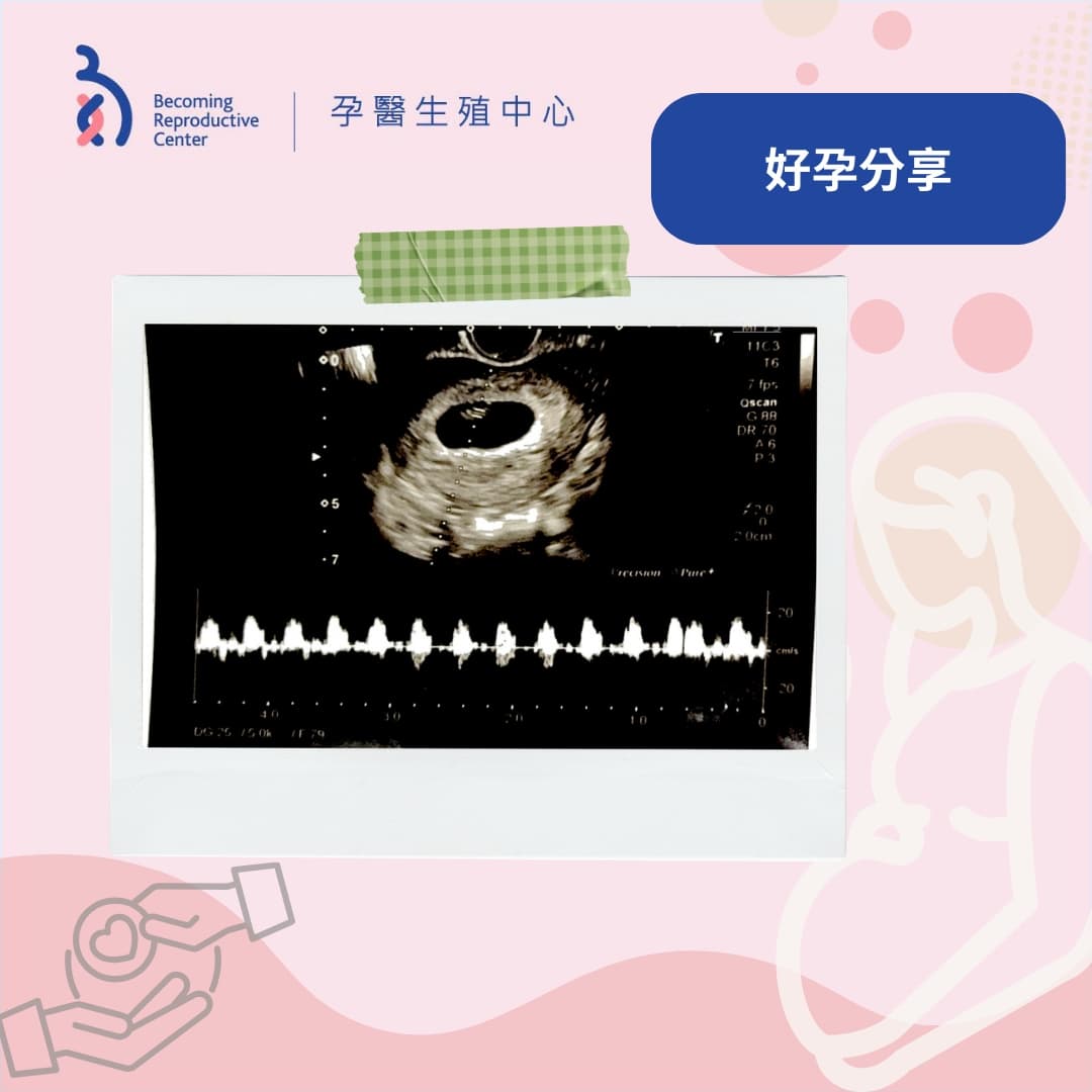 五次試管療程失敗後…46歲的她終於等到這一聲心跳💓.jpg